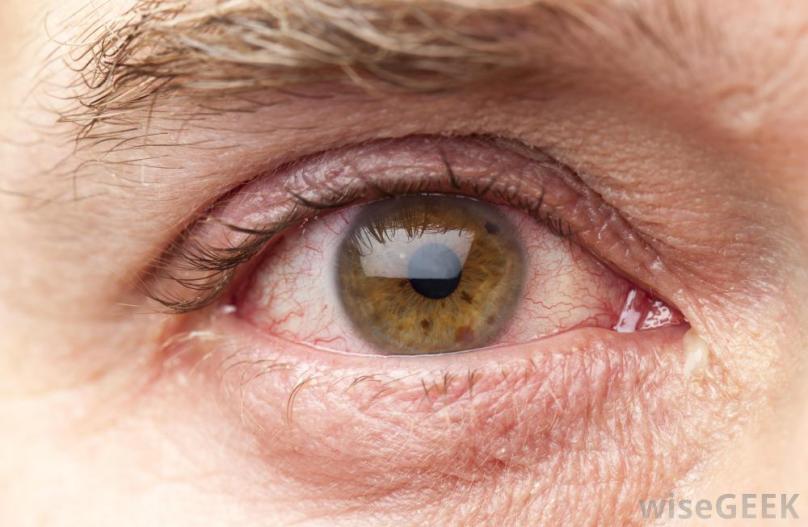 It’s A Horrible Feeling!